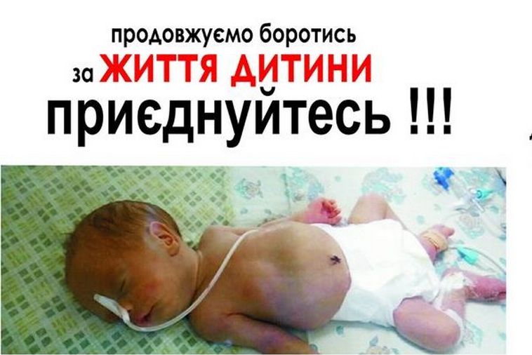 Картинка к: Крошечный мальчик из Никополя продолжает бороться за жизнь. Нужна помощь!