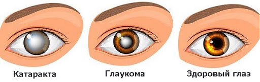Картинка к: Лечение глаукомы и других глазных заболеваний в офтальмологической клинике в Киеве