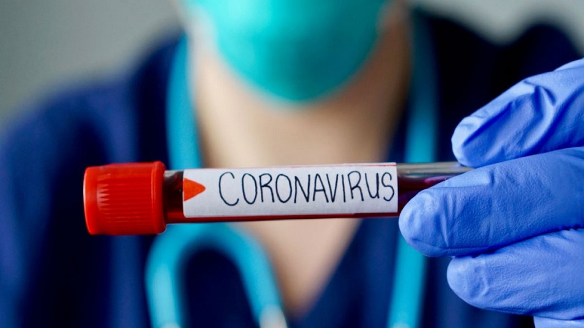 Картинка к: У жителя Никополя выявили коронавирус
